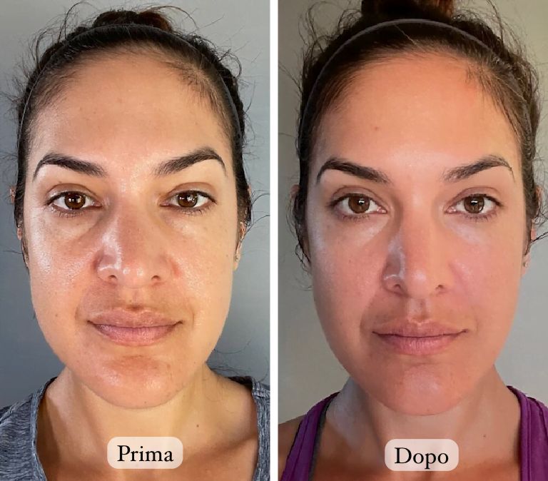 Brandio™ – Massaggiatore Viso Rassodante